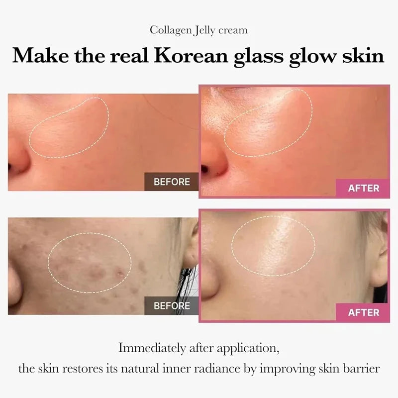 100g Gelee Gesichtscreme Kollagen Soft SPA Nährend Befeuchten Gesicht Schrumpft Poren Entfernen Komedonen Gelee Essenz Koreanische Hautpflege